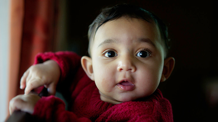 sugar bug, sugar bug baby blue vein between eyes, baby with sugar bug vein